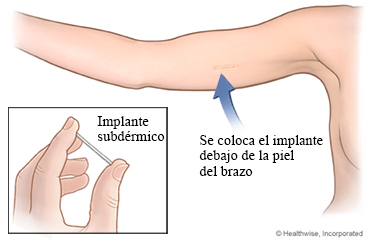 ../images/d1470ae480a1d32836fcb81cd7a04196.jpg